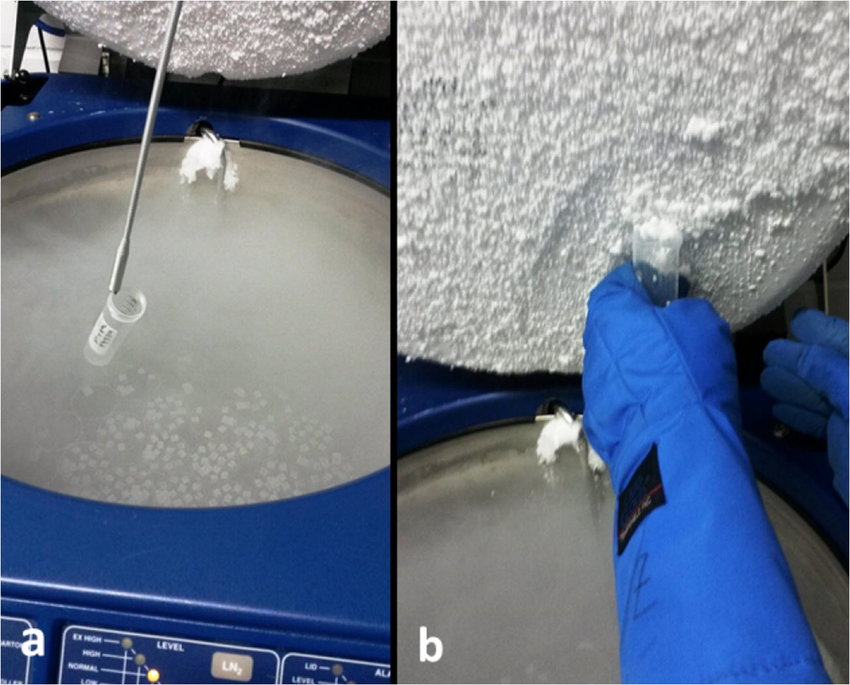 液氮容器 液氮容器